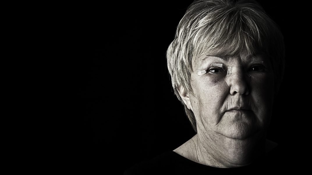 Violence against family caregivers: Symptom of the disease or abuse? 1 Face close-up of a serious and injured mature woman with bruises and bandages.