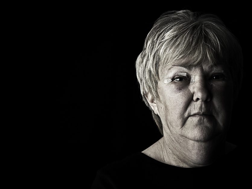 Face close-up of a serious and injured mature woman with bruises and bandages.
