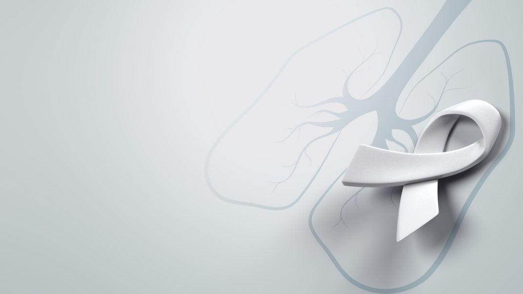 Lung Cancer Awareness Month: Four things you can do to protect your lungs 1 lung cancer awareness month92139a23 0be7 4ed6 88f0 575cf1408476