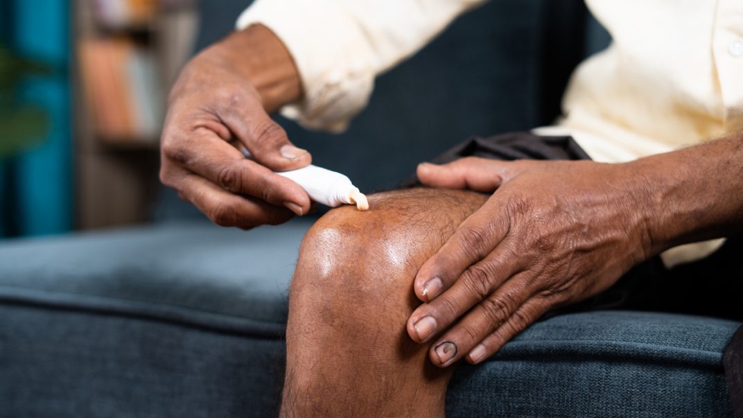 Caring for the skin you are in: What works? 1 Older adult sitting on a couch and applying ointment to their knee.