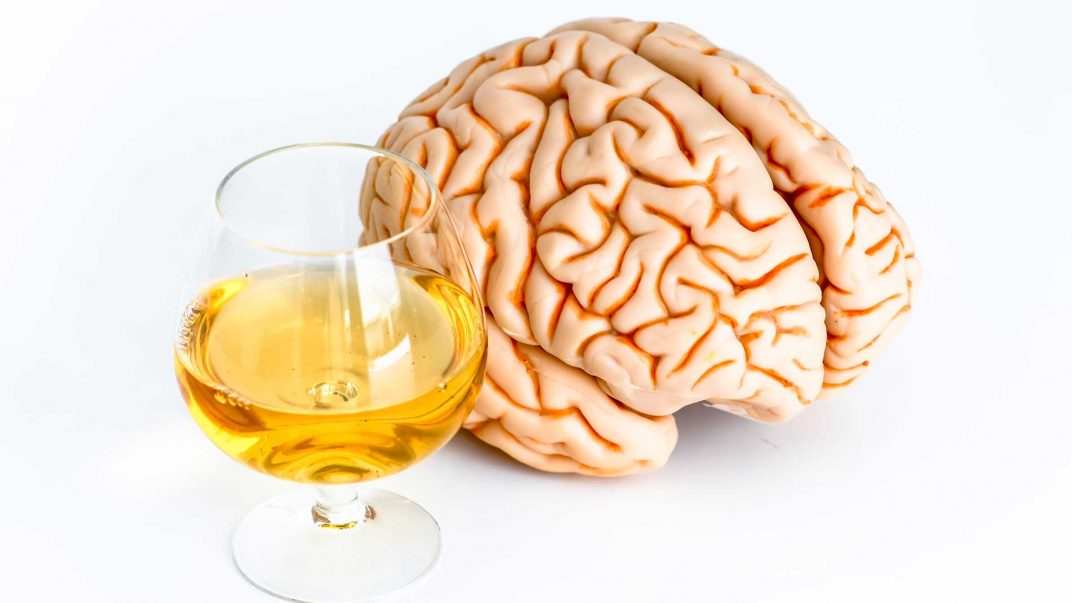 Alcohol and aging: Understanding and recognizing at-risk drinking 1 brain alcohol
