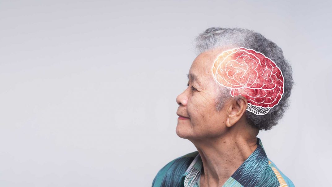 Boost your brain health: 5 evidence-based strategies for healthy aging 1 brain health