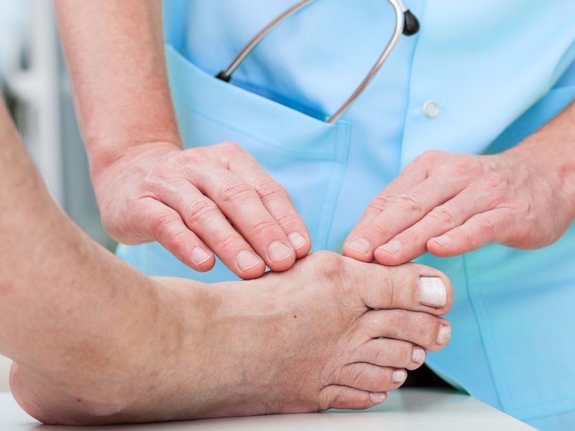 Older adult having their bunion inspected by a healthcare provider.
